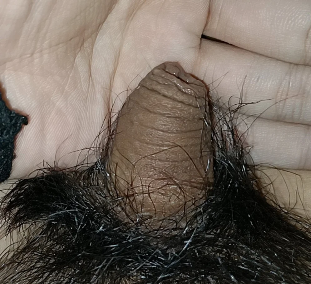 Before comparison 1